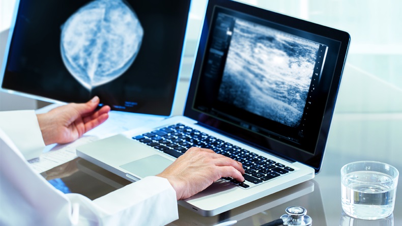 Close up of Doctor reviewing mammography results on x-ray and typing results on laptop. - Image 