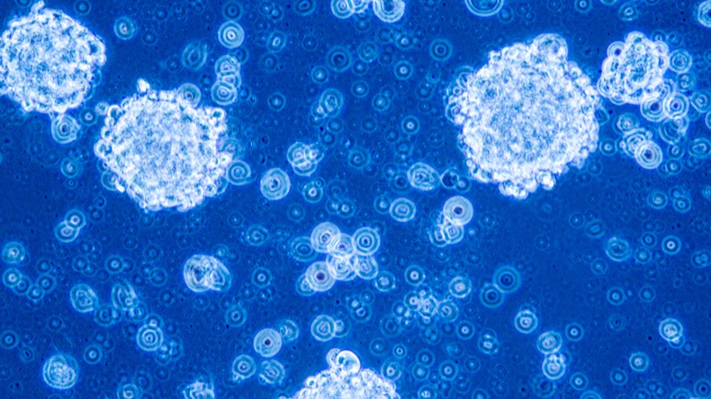 Glioblastoma stem cells organized in tumor niche formation - Image 