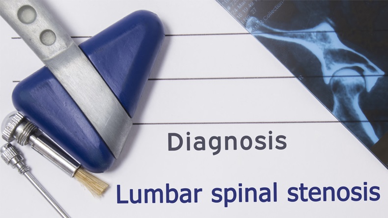 Neurological diagnosis of Lumbar Spinal Stenosis. Neurologist directory, where is printed diagnosis Lumbar Spinal Stenosis, lies on workplace with MRI image and neurological diagnostic tools close-up - Image 
