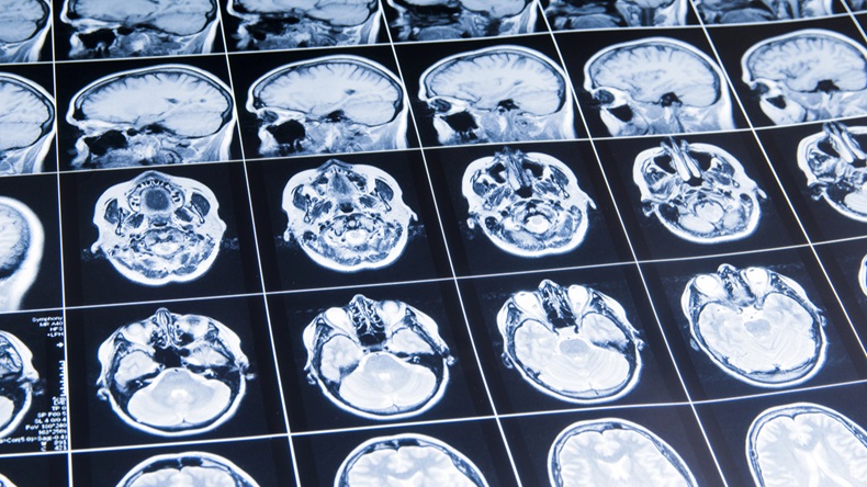 MRI of the brain. snapshot - Image 