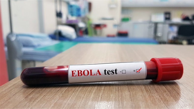 Positive Ebola test and laboratory sample of blood testing for diagnosis Ebola infection. Ebola virus disease(EVD)cause hemorrhagic fever(EHF).Tropical infectious and diagnostic technology concept