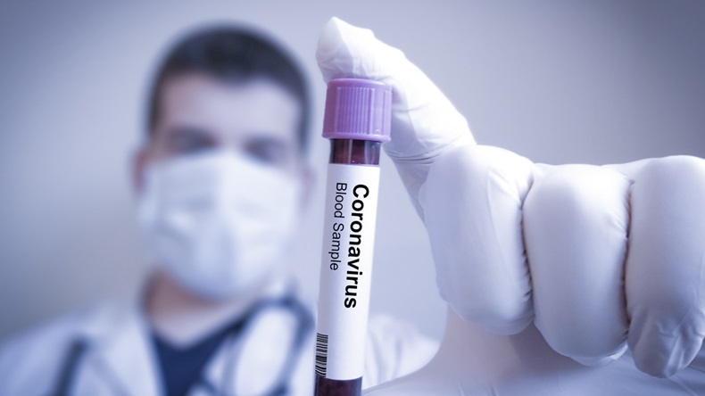 Coronavirus blood sample 