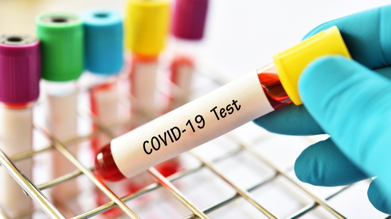 Test tube with blood sample for COVID-19 test, novel coronavirus 2019 found in Wuhan, China