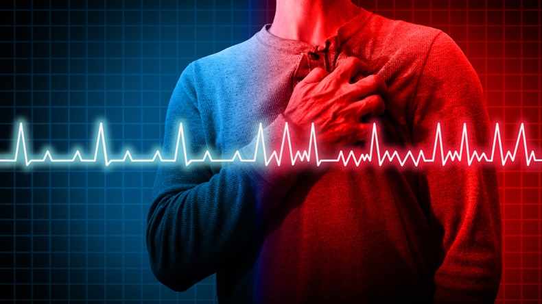Heart disorder and atrial fibrillation ecg as a coronary cardiac attack with irregular and normal organ rhythm as a chest discomfort disease concept in a 3D illustration style.