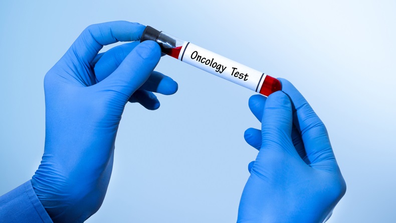 Positive result of blood test for oncology. Test tube with a blood test in the doctor's hands. Medical concept.