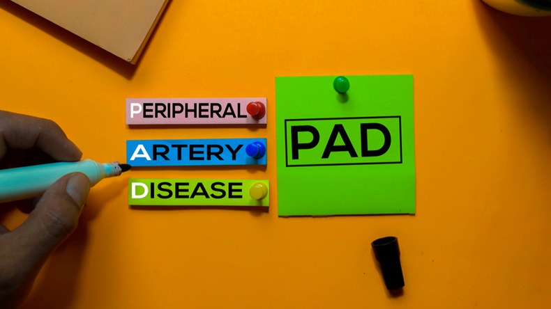 PAD. Peripheral Artery Disease acronym on sticky notes. Office desk background