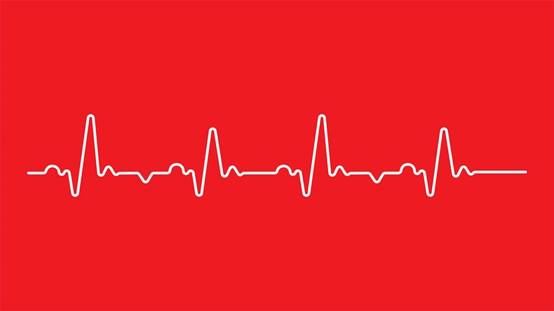 Heart beat monitor; pulse line