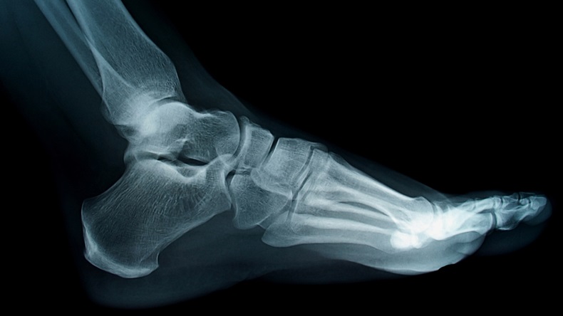 Foot and ankle xray
