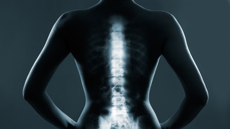 Human backbone in x-ray, on gray background