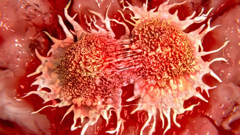 Artwork of cancer cells dividing. - Image ID: E1KHA2