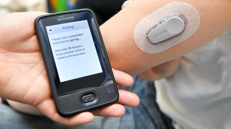 A Dexcom G6 Continuous Glucose Monitoring (CGM) System is fixed to a patient's arm in a medical clinic at the University of Bristol