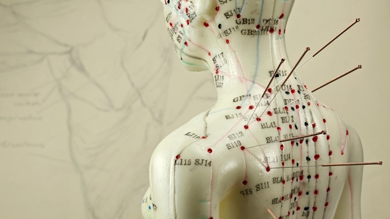 Female acupuncture statue with needles in the shoulder.