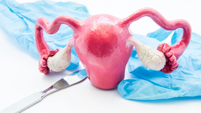 3D model of female uterus near scalpel and medical gloves. 