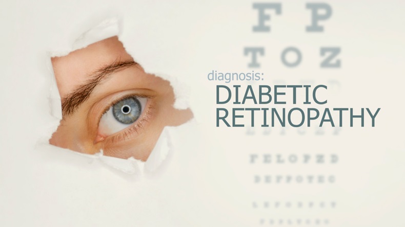 Diabetic Eye 