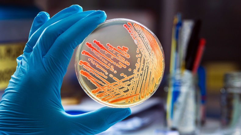 Bacteria Testing Dish 
