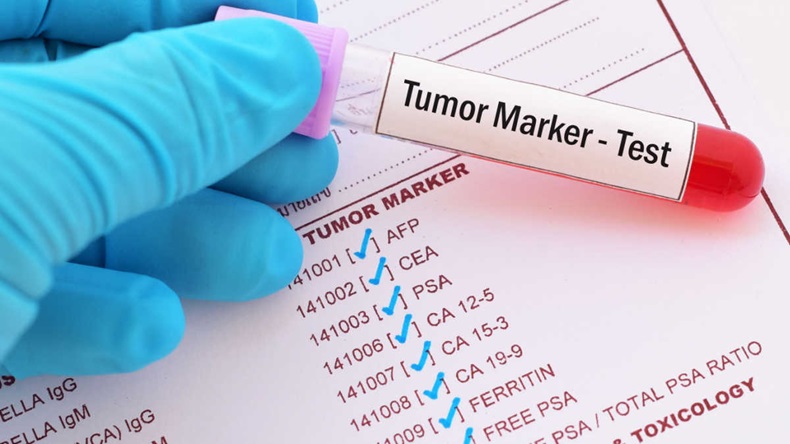 Cancer tumor biomarker test