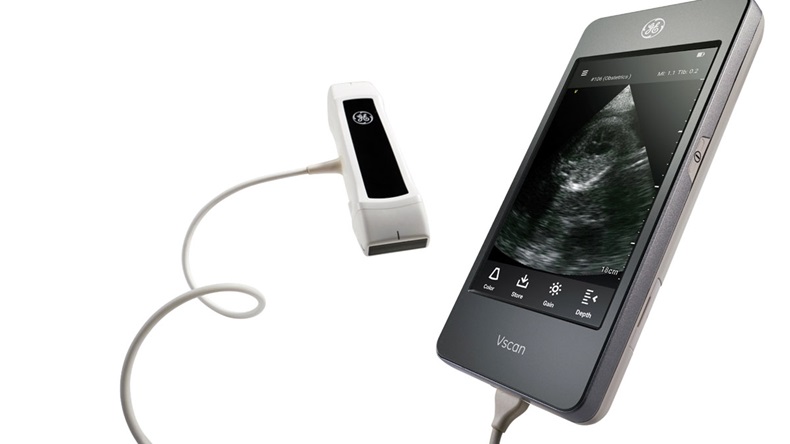 GE Healthcare_Vscan Extend ultrasound